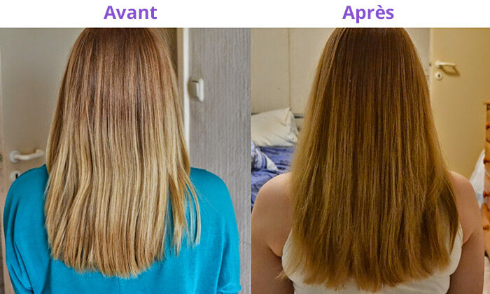 forcapil résultat avant après